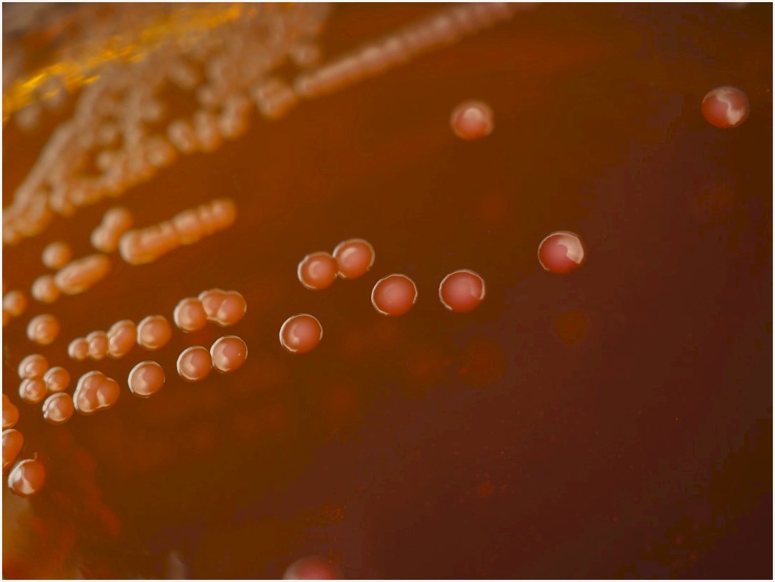 a close up of a bunch of pills on a table